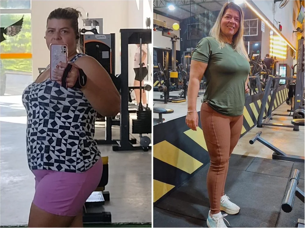 Dalzilei Trova antes e depois