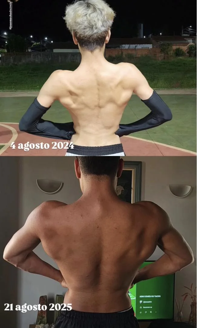 João Mariano antes e depois
