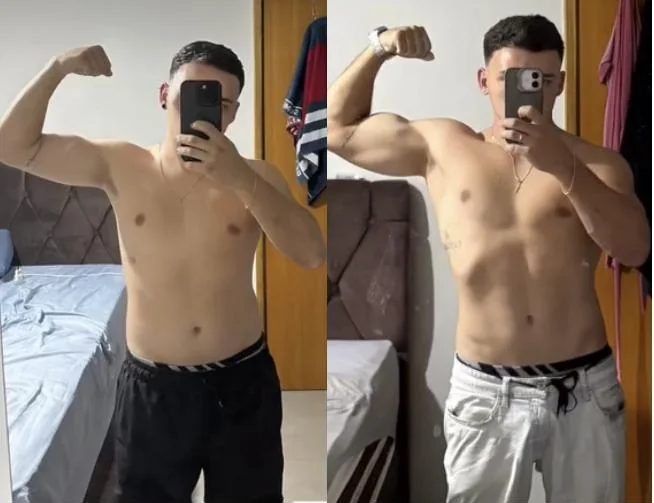 Vinicius Morales antes e depois